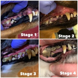 Dental Disease Stages